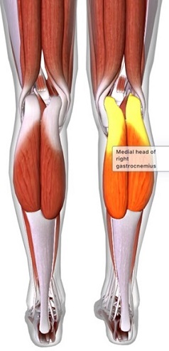 picture of human highlighting the Gastrocnemius muscle