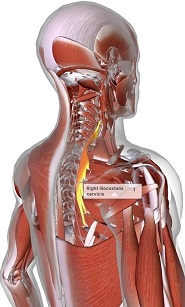 picture of human highlighting the Iliocostalis cervicis muscle