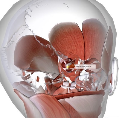 picture of human highlighting the Medial rectus muscle