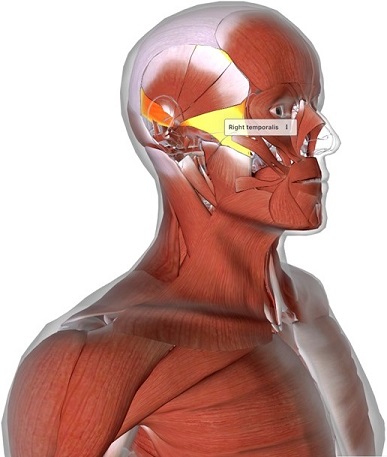 picture of human highlighting the Temporalis muscle