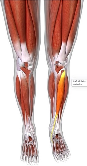 picture of human highlighting the Tibialis anterior muscle