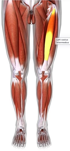 picture of human highlighting the Vastus intermedius muscle